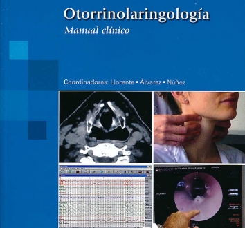Otorrinolaringología. Manual clínico